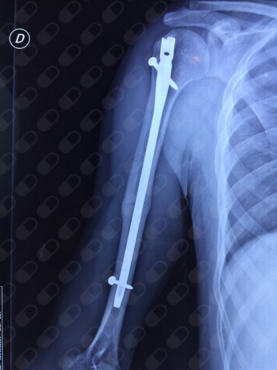 Andrés Ruiz Martínez-7