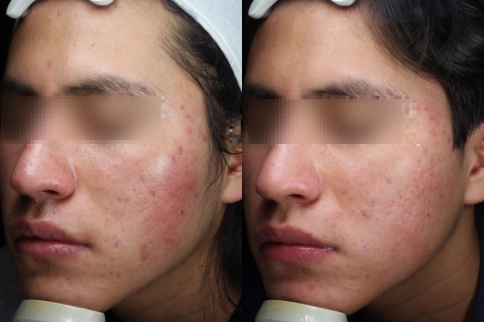 Dafne Arellano Montalvo-46