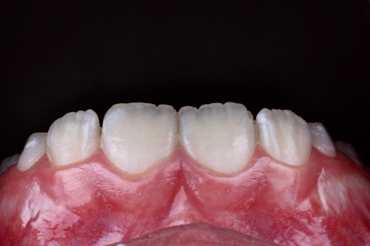 Dilan González Castrejon-21