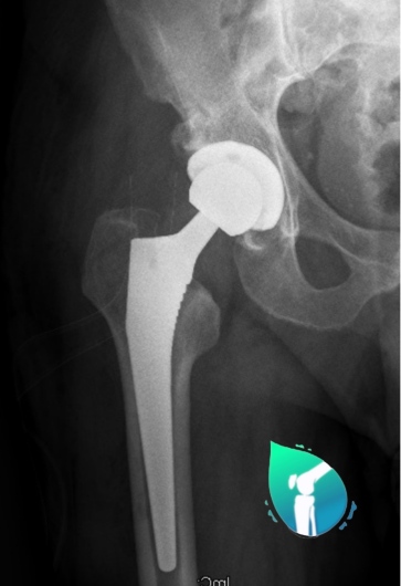 Juan Eduardo Aponte Fonseca-3