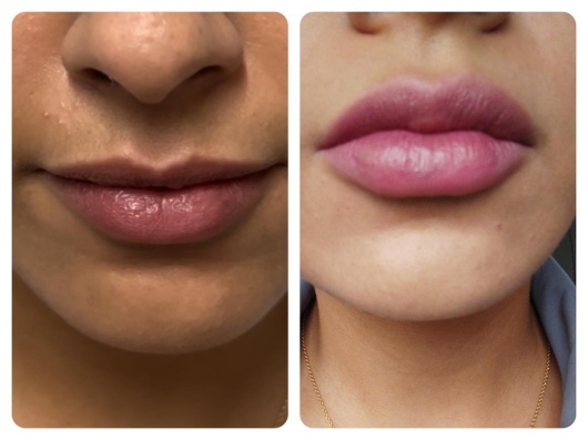 Arturo Romero Grande-5