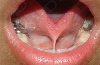 Amparo Sumano Gotoo-4