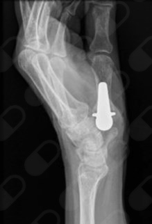 Oscar Fernando Orozco Romo-6