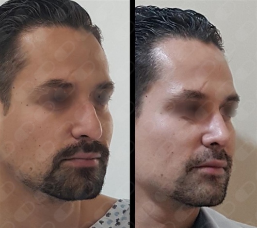 Norma Angélica León Villagrán-8