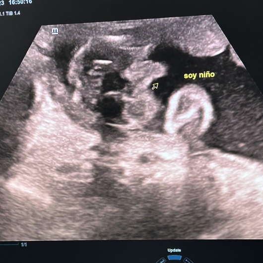 Luis Alberto Acedo Cruz-8