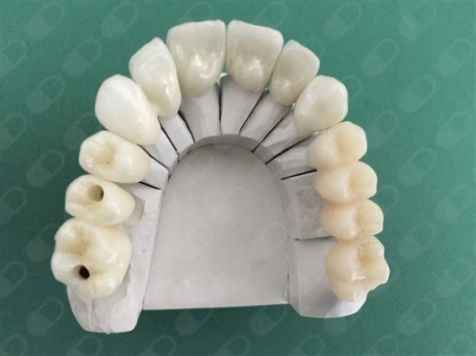 Gerardo Padrón Lagunes-9