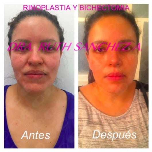 Ruth Sánchez Alvarez-16