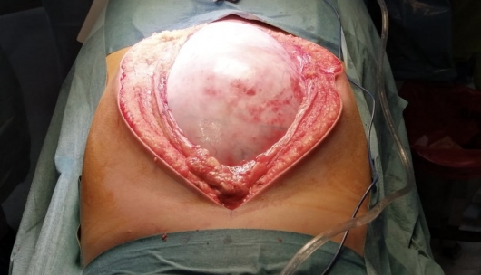 César Espejel Valdés-27