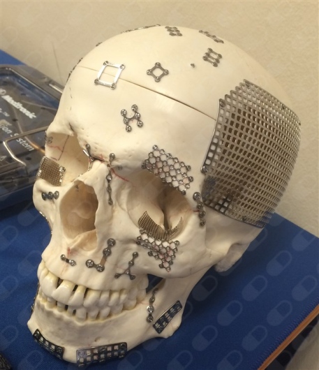 Alejandro Carlos Audiffred Mayoral-7