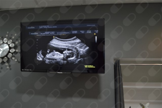 Gustavo Castillejo Torres-4