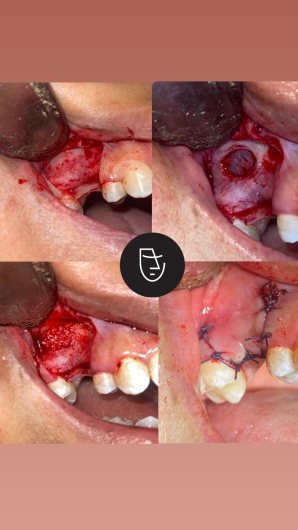 Ayrton Arriola Rivera-3