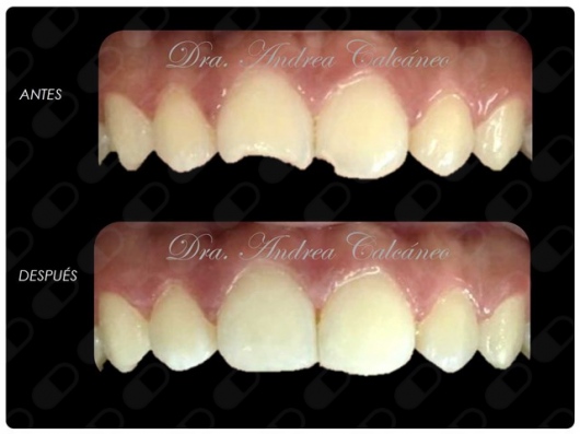 Andrea Calcáneo Castañeda-8