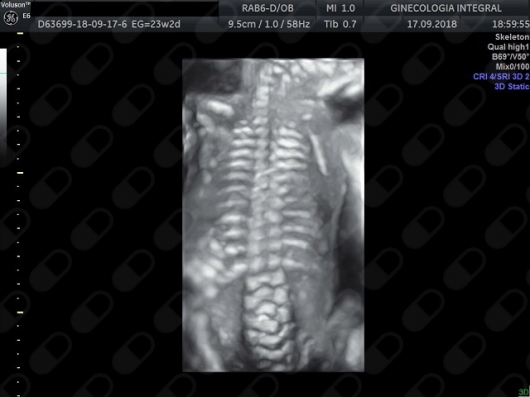 Oscar Alejandro Sánchez Gámez-24