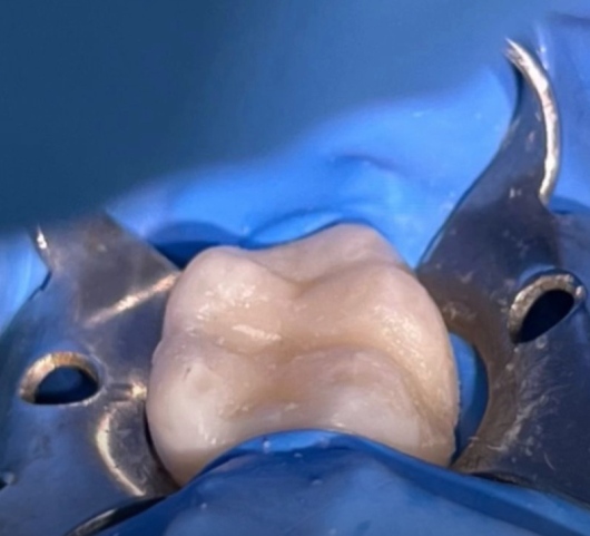 Uriel Alvarado Castillo-5