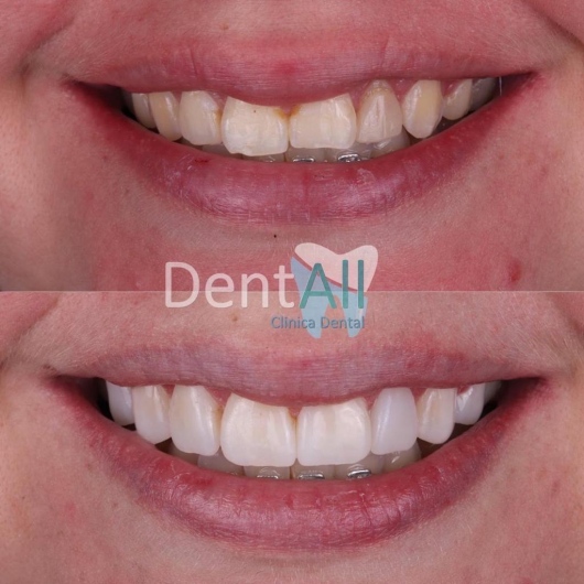 Itzel Serrano Beltran-14