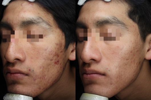 Dafne Arellano Montalvo-23