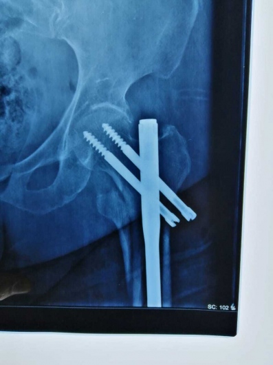 Valerio Licerio De La Cruz-23