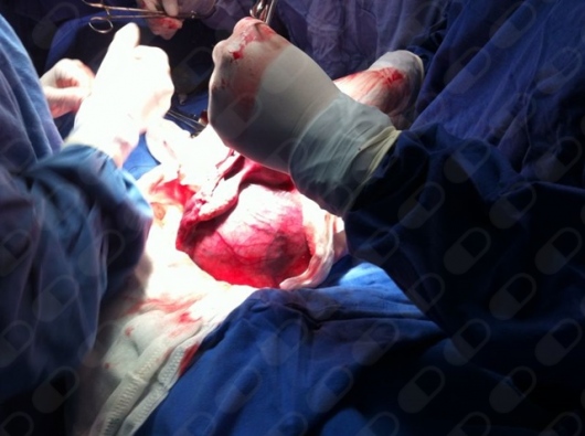 Mariella Granillo Alvarez-3