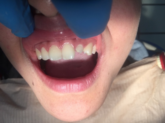 Arturo Romero Grande-34