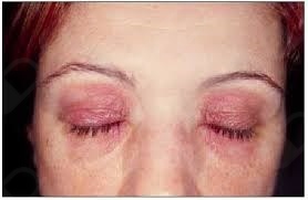 Miguel Angel Melgarejo Ramos-7