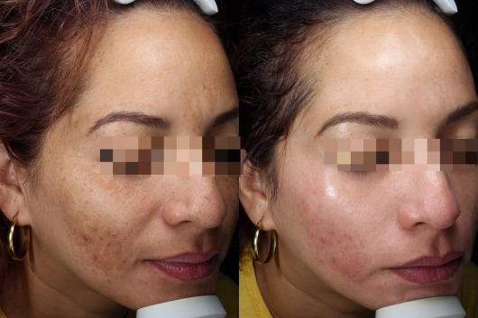 Dafne Arellano Montalvo-27