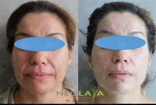 Xochitl Andrea Avalos Alvarez-19