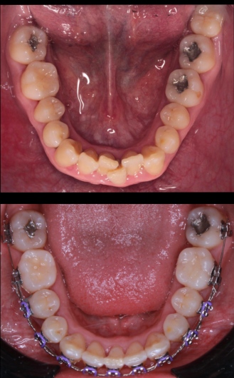 Uriel Alvarado Castillo-2