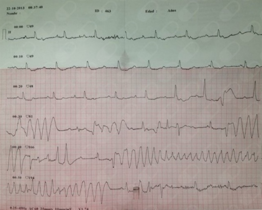 Alex Daniel Pacheco Bouthillier-9