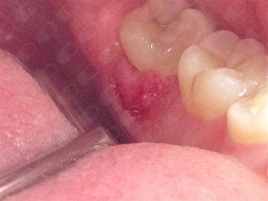 María Teresa Gómez Serrano-20