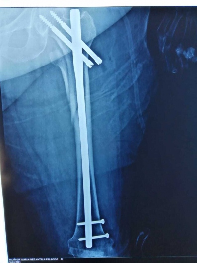 Valerio Licerio De La Cruz-17