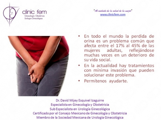 David Mijey Esquivel Izaguirre-5