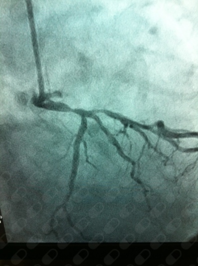 Carlos Alberto Becerra Laguna-5