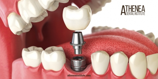 Leonel Palma Carlos-32