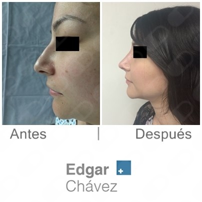 Edgar Chávez Oseguera-4