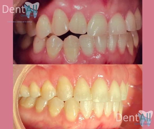 Itzel Serrano Beltran-10