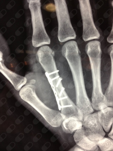 Samuel Sebastian Castañon-6