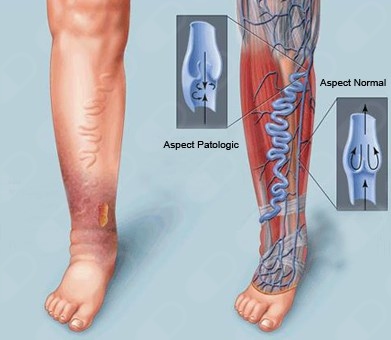 José Roberto Suárez-4