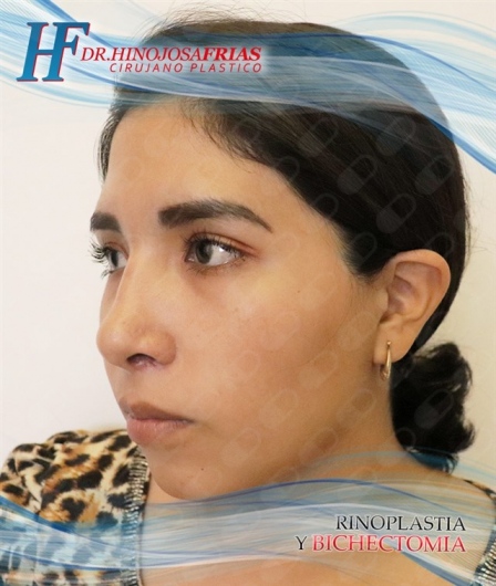 Miguel Ángel Hinojosa Frías-22