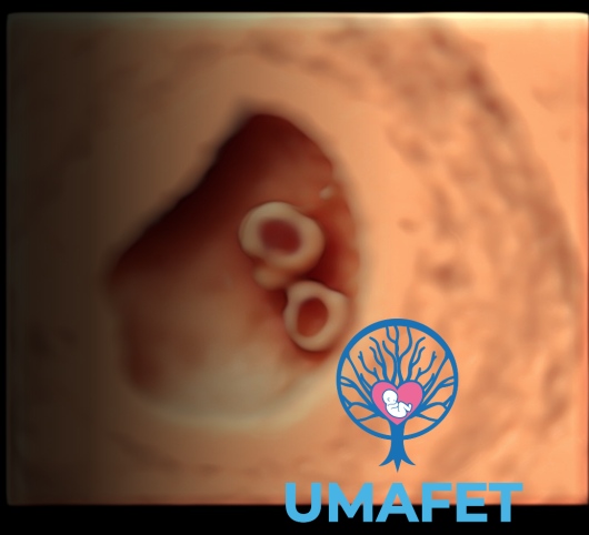 Alejandro Gaspar Vera-3