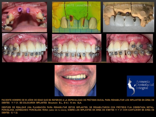 Leonel Brito Armas-2