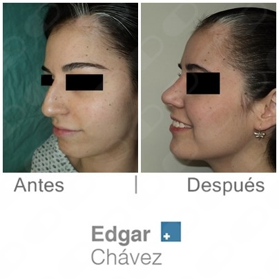 Edgar Chávez Oseguera-2