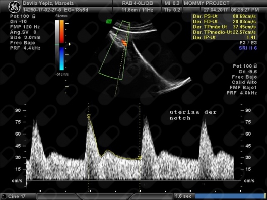 Fabiola Elizabeth Garcia Padilla-30