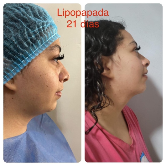 Arturo Romero Grande-25