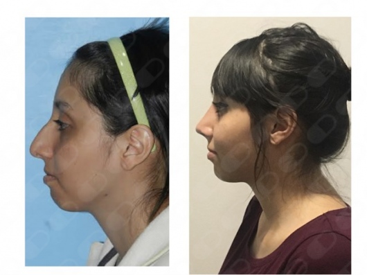 Blanca Santos Mejía-3