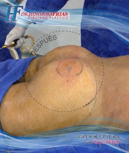 Miguel Ángel Hinojosa Frías-20