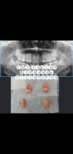 Fabián Alvarado Villanueva-0