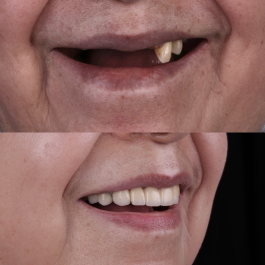 Hugo Moran Negrete-8