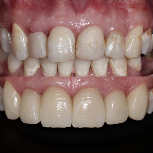 Hugo Moran Negrete-5