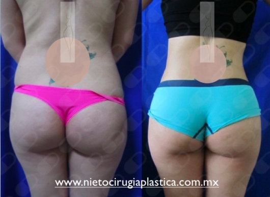 Rubén Nieto Balcázar-16