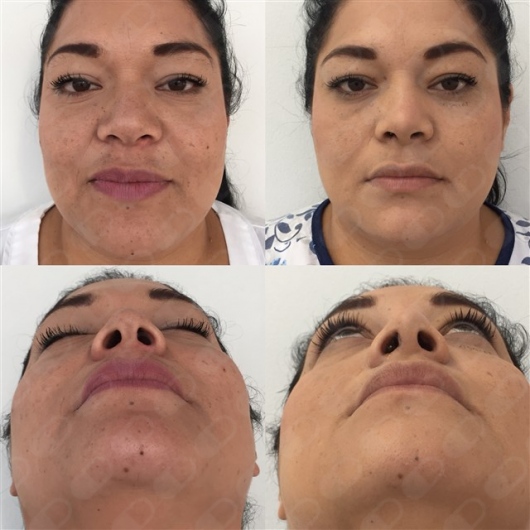 Teresita Flores Saldaña-6